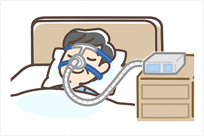 睡眠時無呼吸症候群イメージ画像