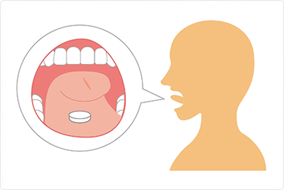 舌下免疫療法 イメージ画像